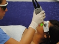depilacion-facial-laser